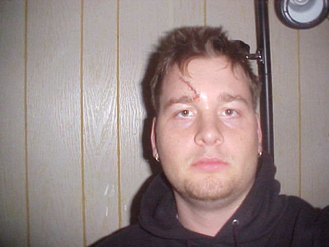 eye.jpg